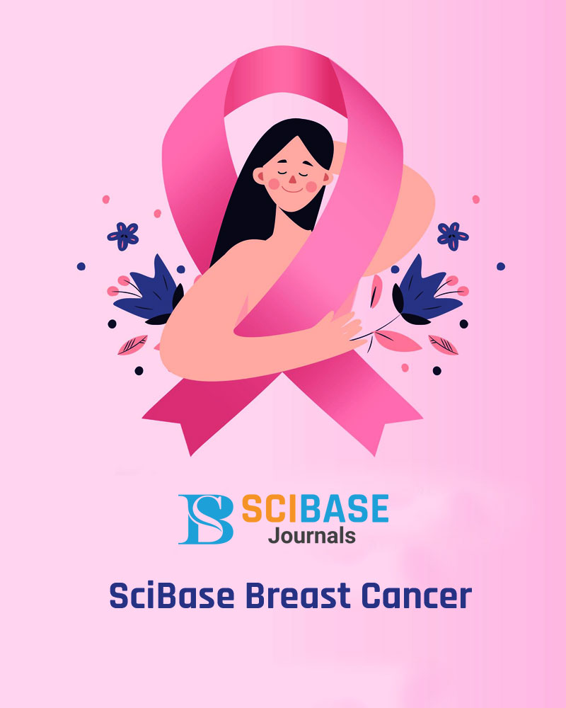 SciBase Breast Cancer